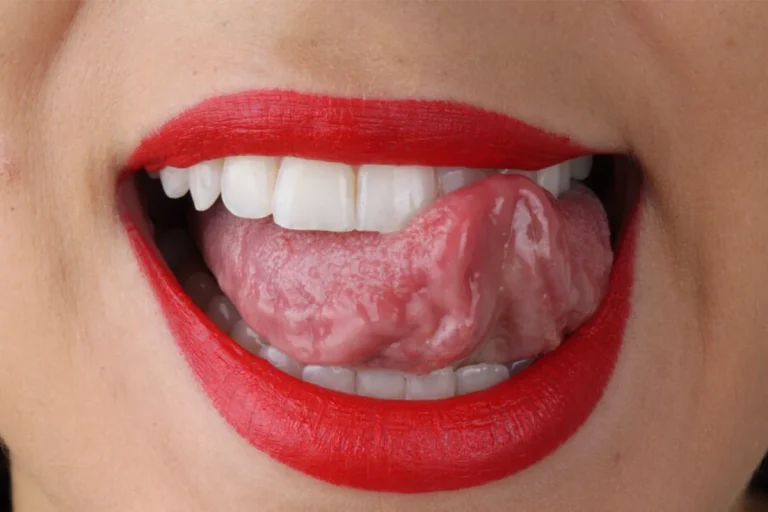 Perdeu um dente? Descubra por que é que não deve adiar a substituição.